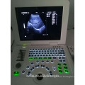 preço da máquina de ultra-som e máquina de ultra-som para a gravidez